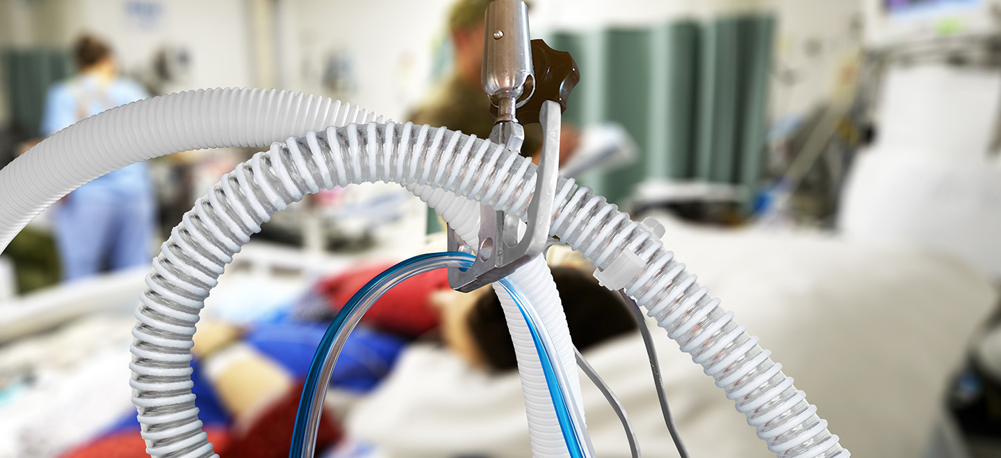 What is Mechanical Ventilation? Advanced Mechanical Ventilation Circuit  Solutions by GaleMed