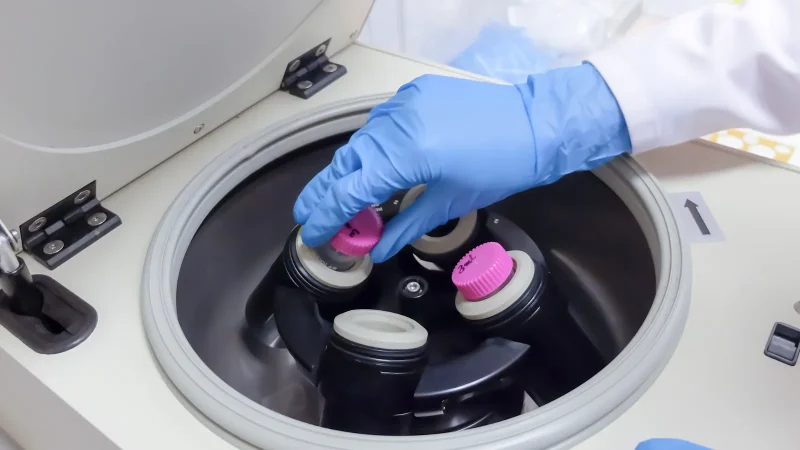 dc32dc6357c1e40a5086befd6a4f0ca9_Centrifuge-Top-Tips-Part-2-Proper-Use-and-Safety-1.png